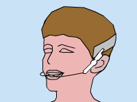 Illustration of a young man wearing orthodontic headgear 
